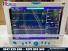 Monitor theo dõi bệnh nhân contec cms9000
