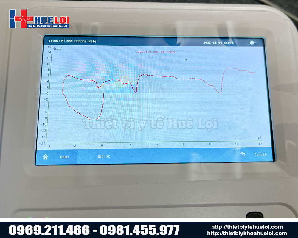 biểu đồ kết quả máy đo chức năng hô hấp để bàn giá rẻ 