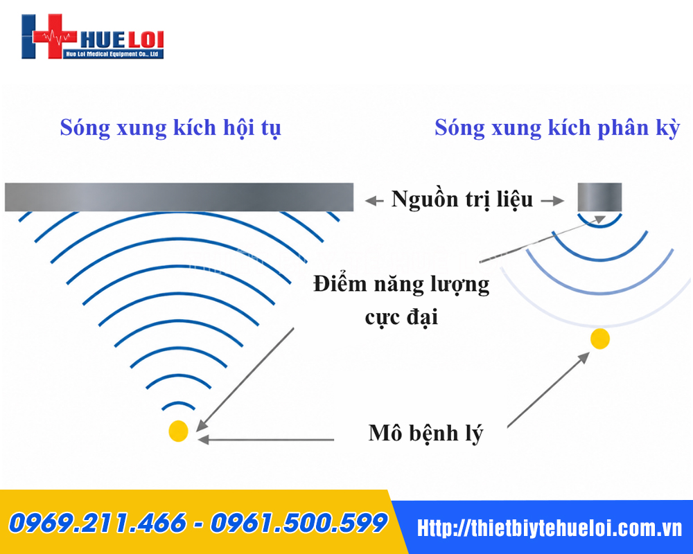 Sơ đồ so s&aacute;nh nguy&ecirc;n l&yacute; s&oacute;ng xung k&iacute;ch hội tụ v&agrave; ph&acirc;n kỳ của m&aacute;y PIEZONIA