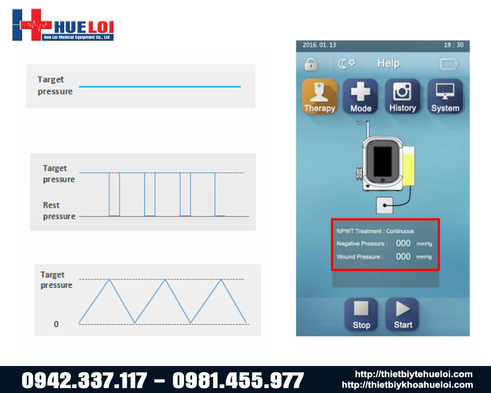 các chế độ điều trị của máy hút áp lực âm 