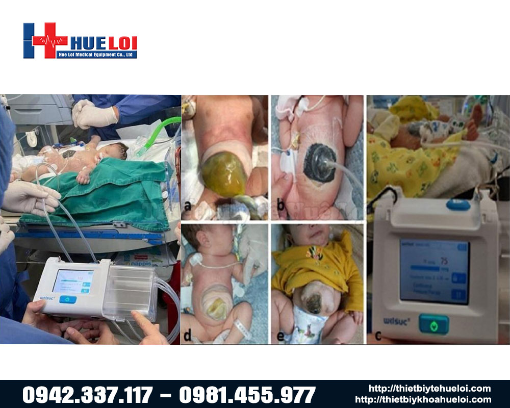 đa dạng các đối tượng có thể sử dụng máy RH-1000