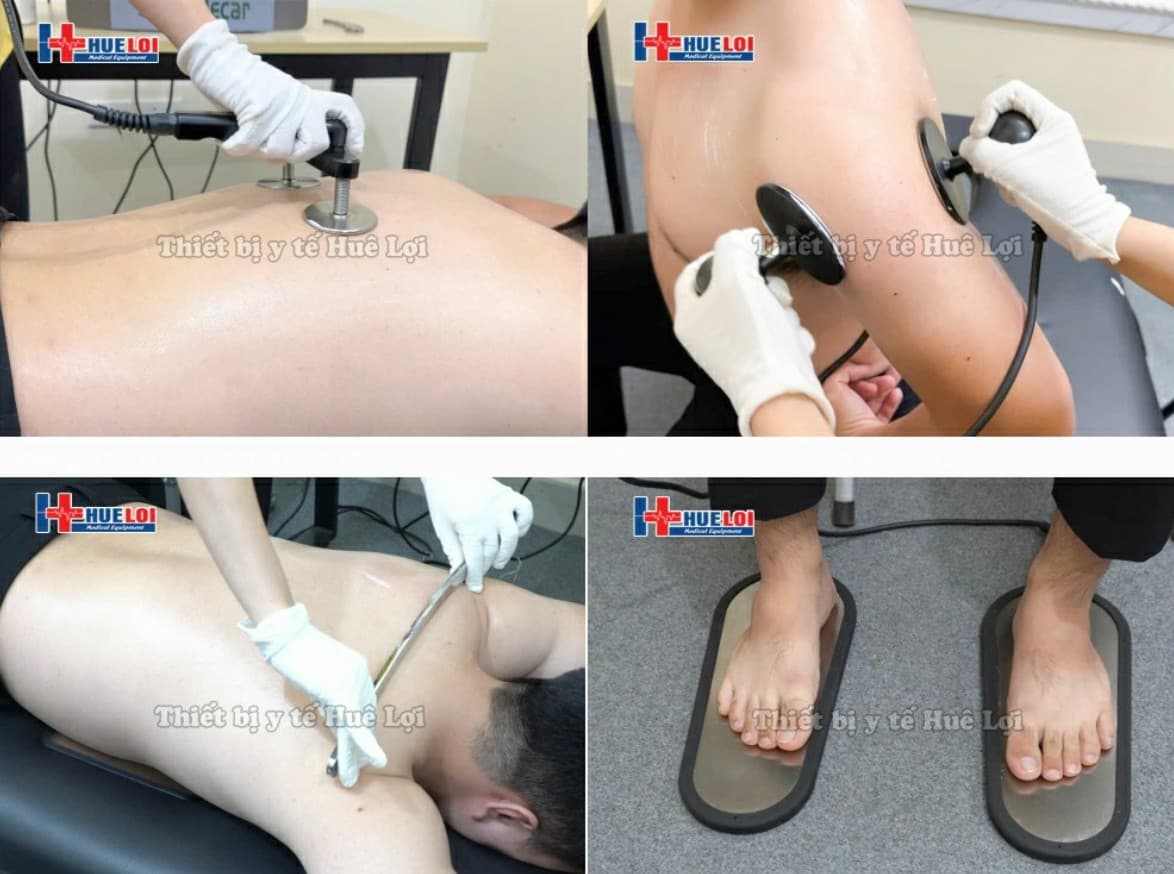 Điều trị bằng máy tecar