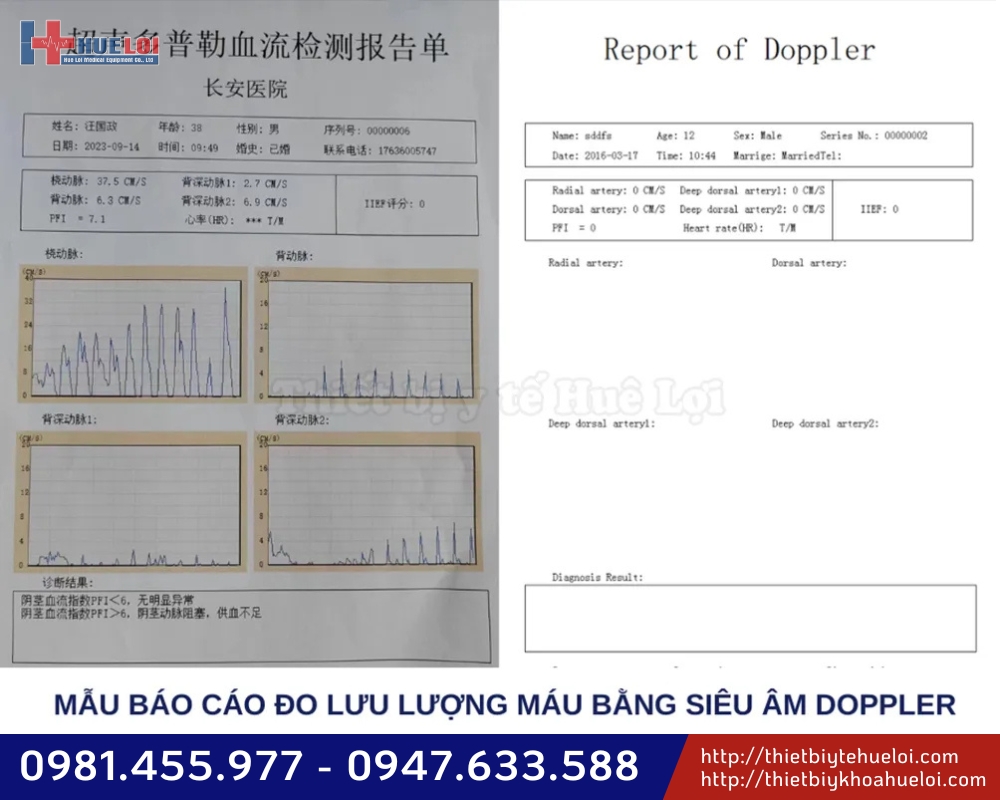 phiếu trả kết quá máy chẩn đoán rối loạn chức năng sinh lý nam 
