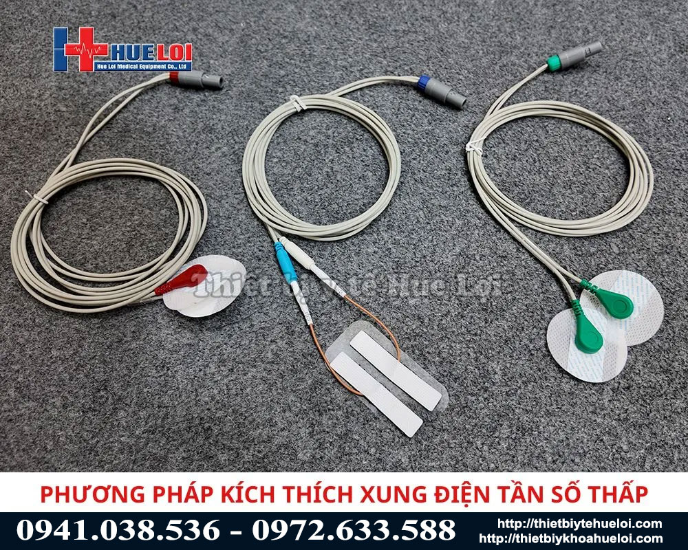 Phương ph&aacute;p điều trị bằng điện trung tần số thấp 