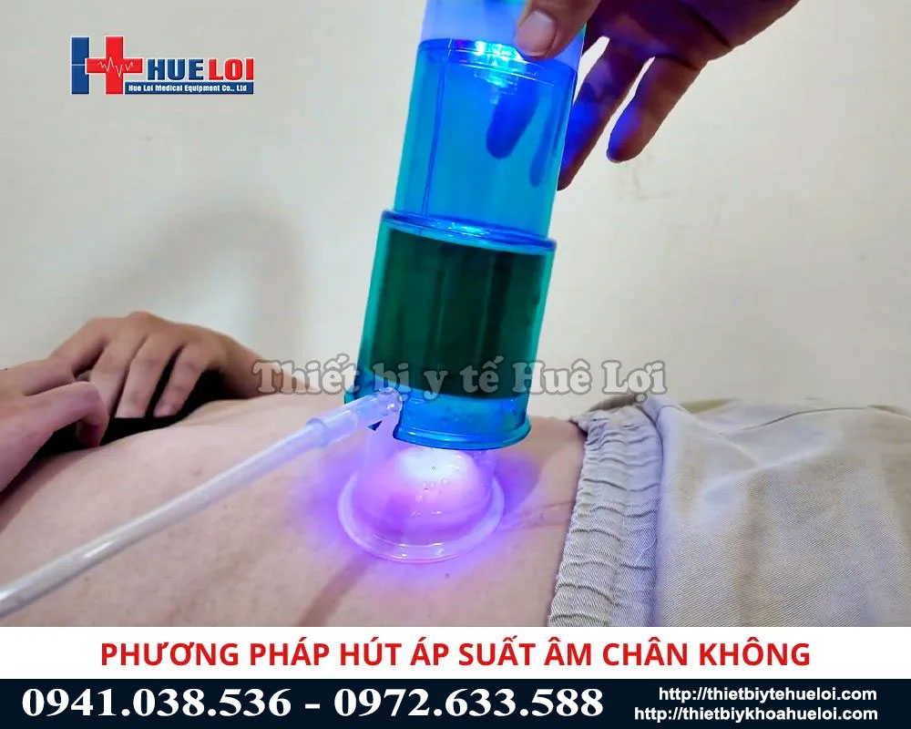 Phương ph&aacute;p h&uacute;t &aacute;p suất &acirc;m 