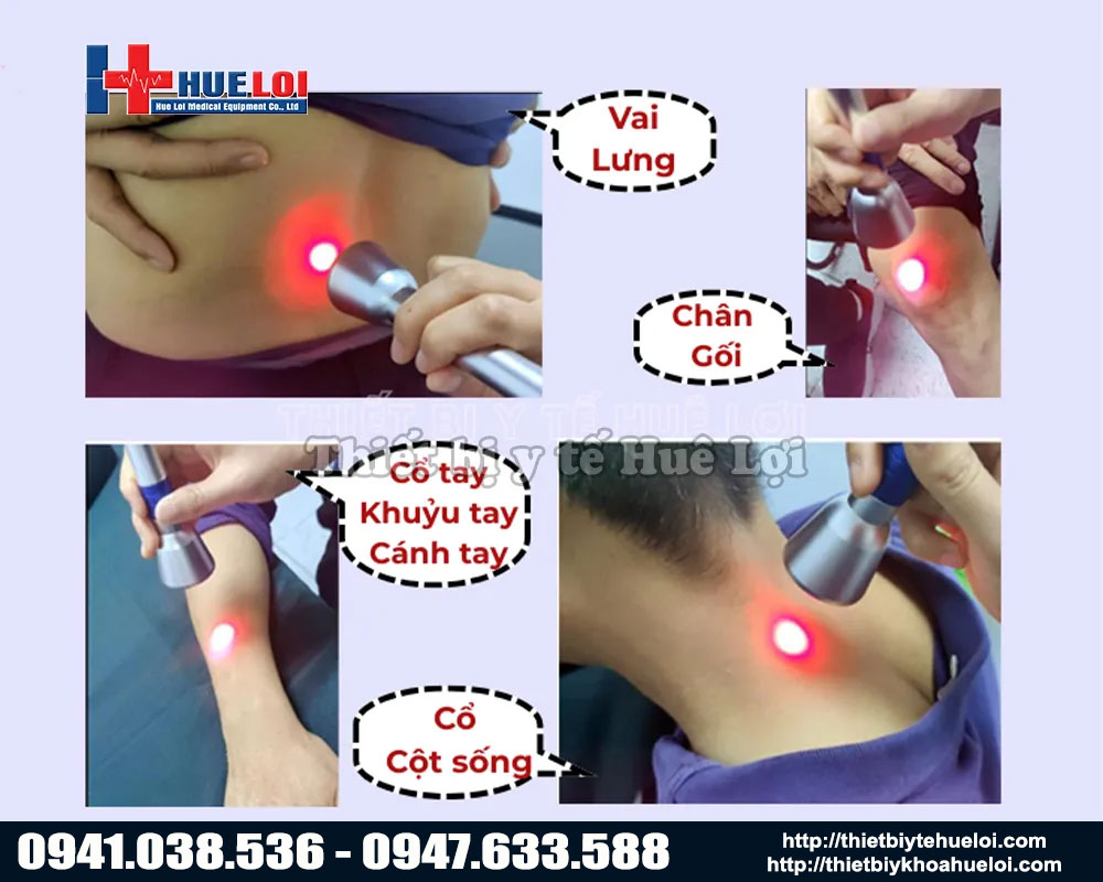 Các vùng điều trị của máy EC30 đa bước sóng