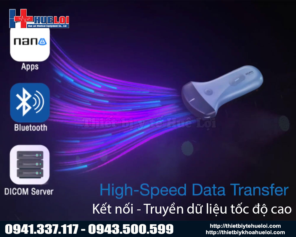 máy chẩn đoán hình ảnh convex nano c5 edan