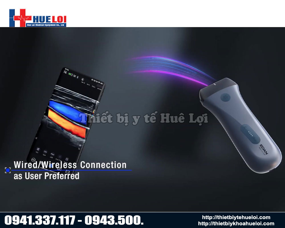 Hình thức kết nối không dây của máy siêu âm cầm tay L12 EDAN
