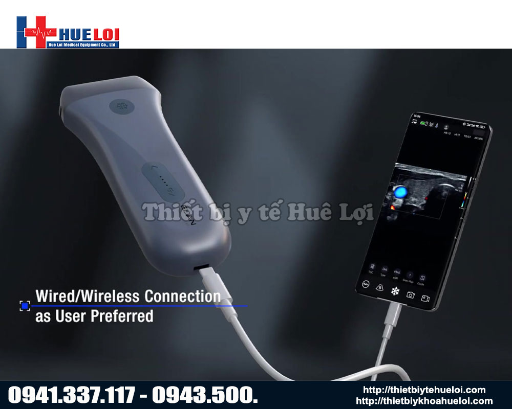 Hình thức kết nối có dây của máy Nano L12 EXP