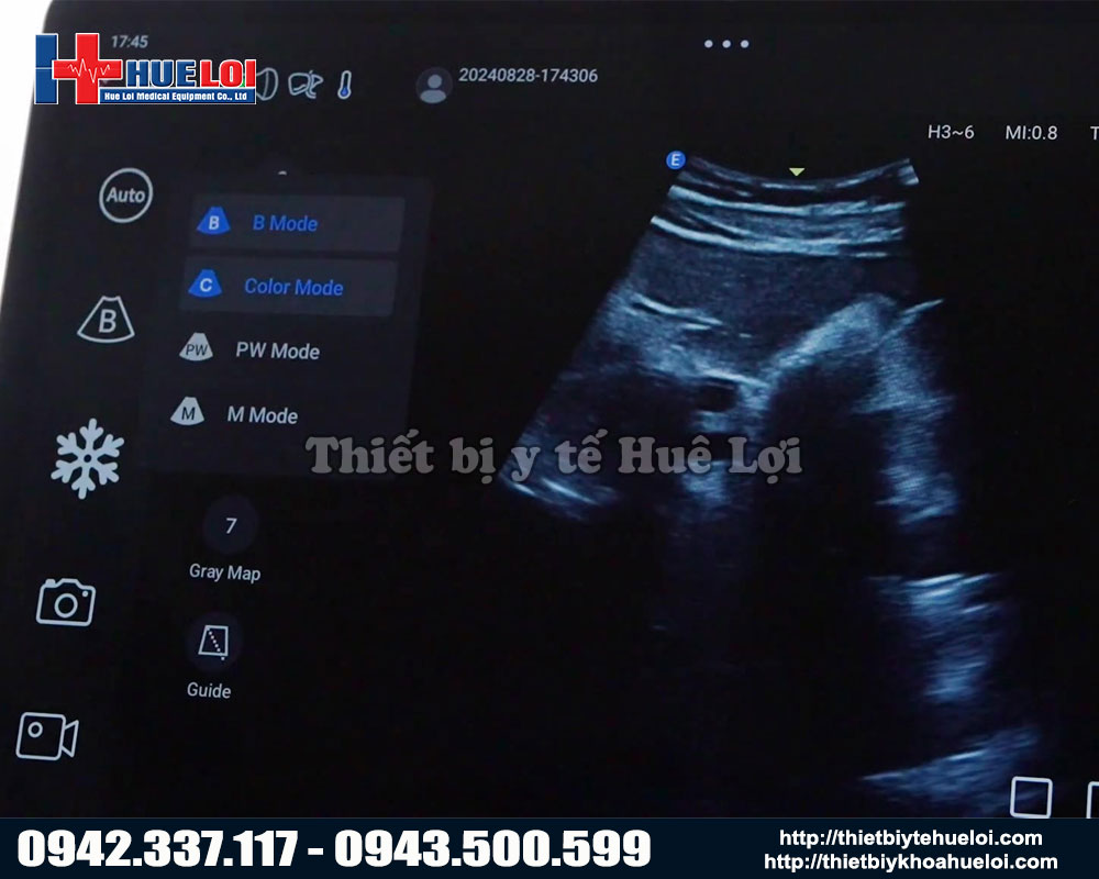 Các chế độ hình ảnh trên máy chẩn đoán hình ảnh tuyến tính