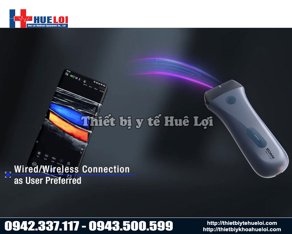Hình thức kết nối không dây của máy siêu âm cầm tay L12 EDAN