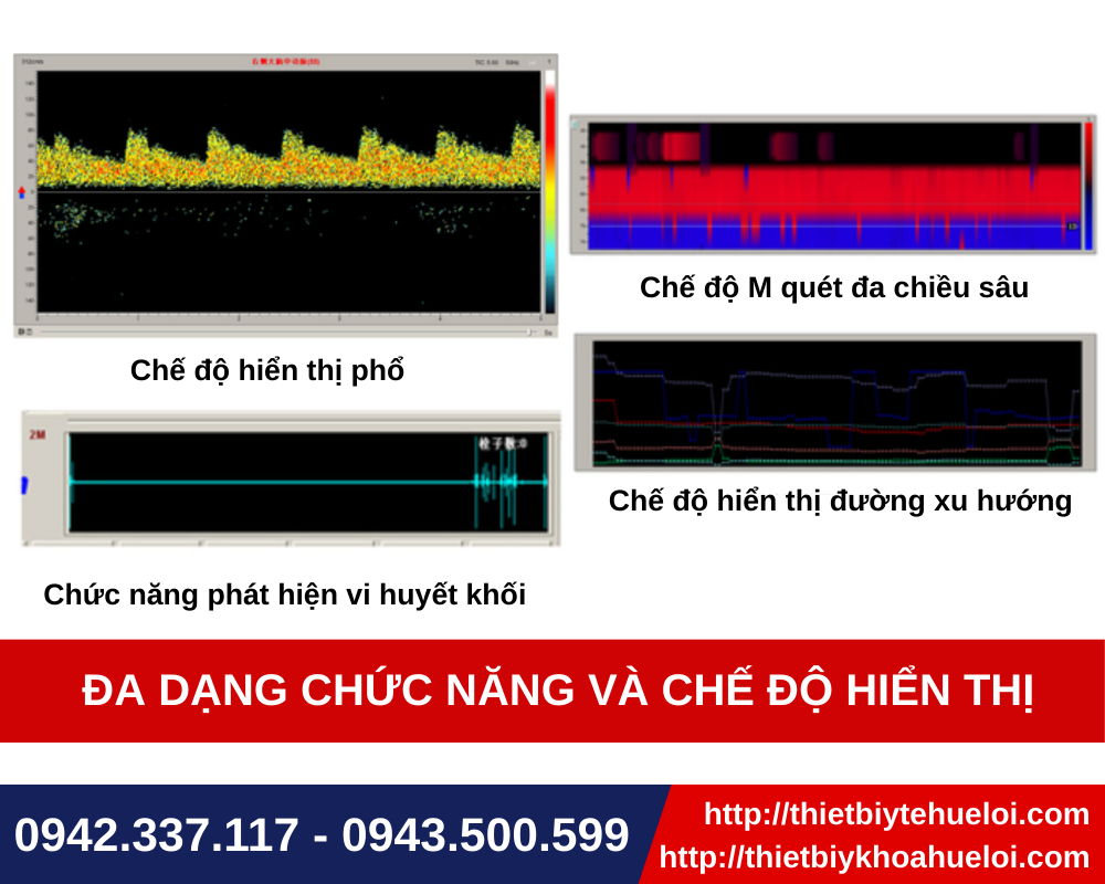 Máy siêu âm doppler xuyên sọ thế hệ mới nhất