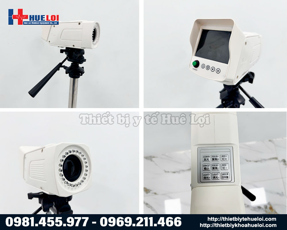 Trọn bộ m&aacute;y soi cổ tử cung Full HD SW 304