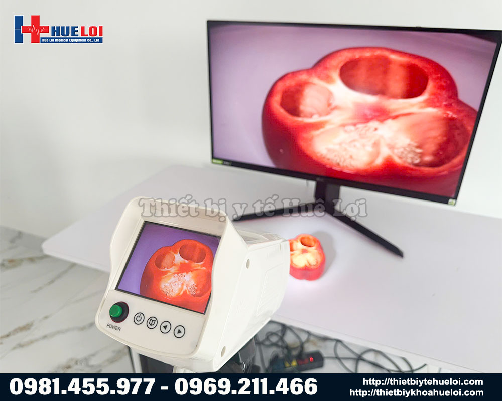 H&igrave;nh ảnh sắc n&eacute;t từ m&aacute;y soi cổ tử cung SW 304