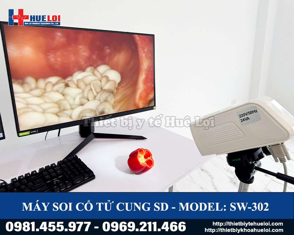 M&aacute;y soi cổ tử cung SW 302 gi&aacute; rẻ ch&iacute;nh h&atilde;ng