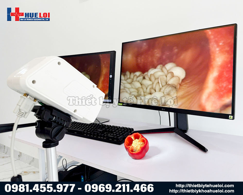 Thiết bị soi cổ tử cung SW 302 trong ph&ograve;ng kh&aacute;m