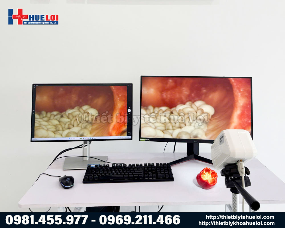 H&igrave;nh ảnh chụp từ m&aacute;y soi cổ tử cung SW 302