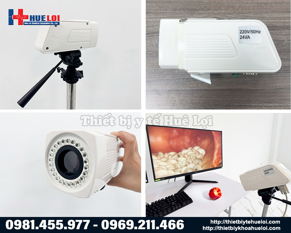 Tổng quan m&aacute;y soi cổ tử cung SW 302 Sanwe