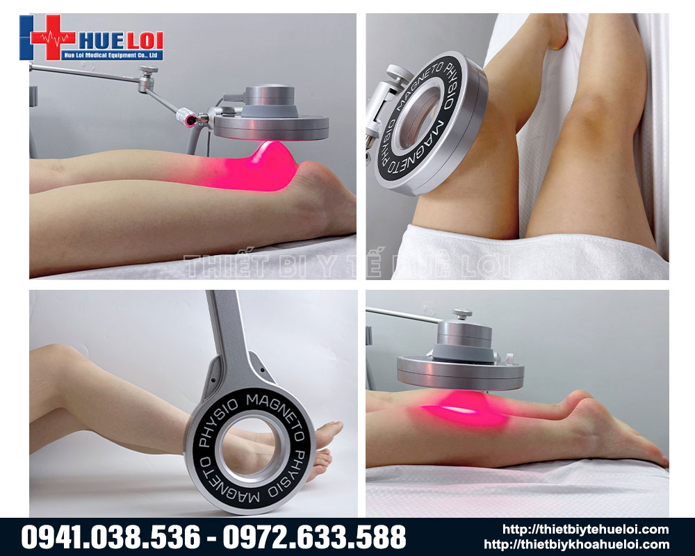 Giảm ph&ugrave; nề v&agrave; đau nhức cơ bắp cho vận động vi&ecirc;n chuy&ecirc;n nghiệp