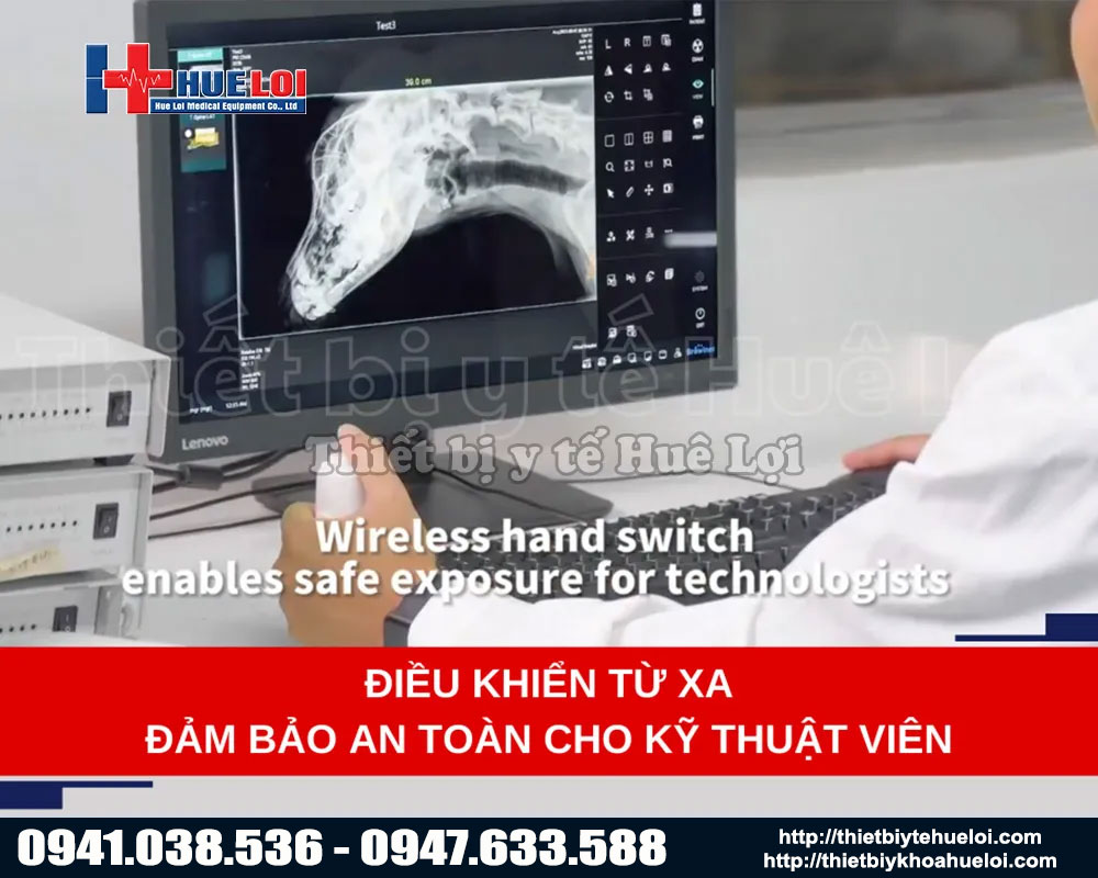 hệ thống điều khiển từ xa thông minh trên máy x quang cố định