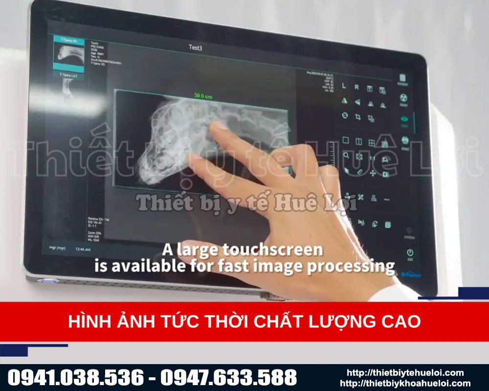 hình ảnh tức thời chất lượng cao 