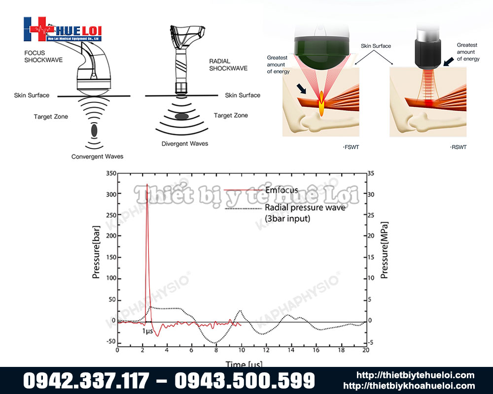 so sánh cơ chế tác động của sóng xung kích hội tụ và phân kỳ
