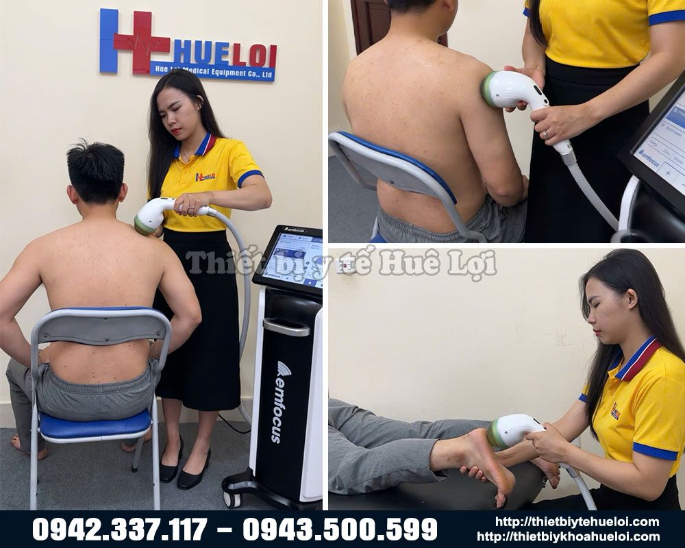 hình ảnh thực tế điều trị máy xung kích hội tụ emfocus 