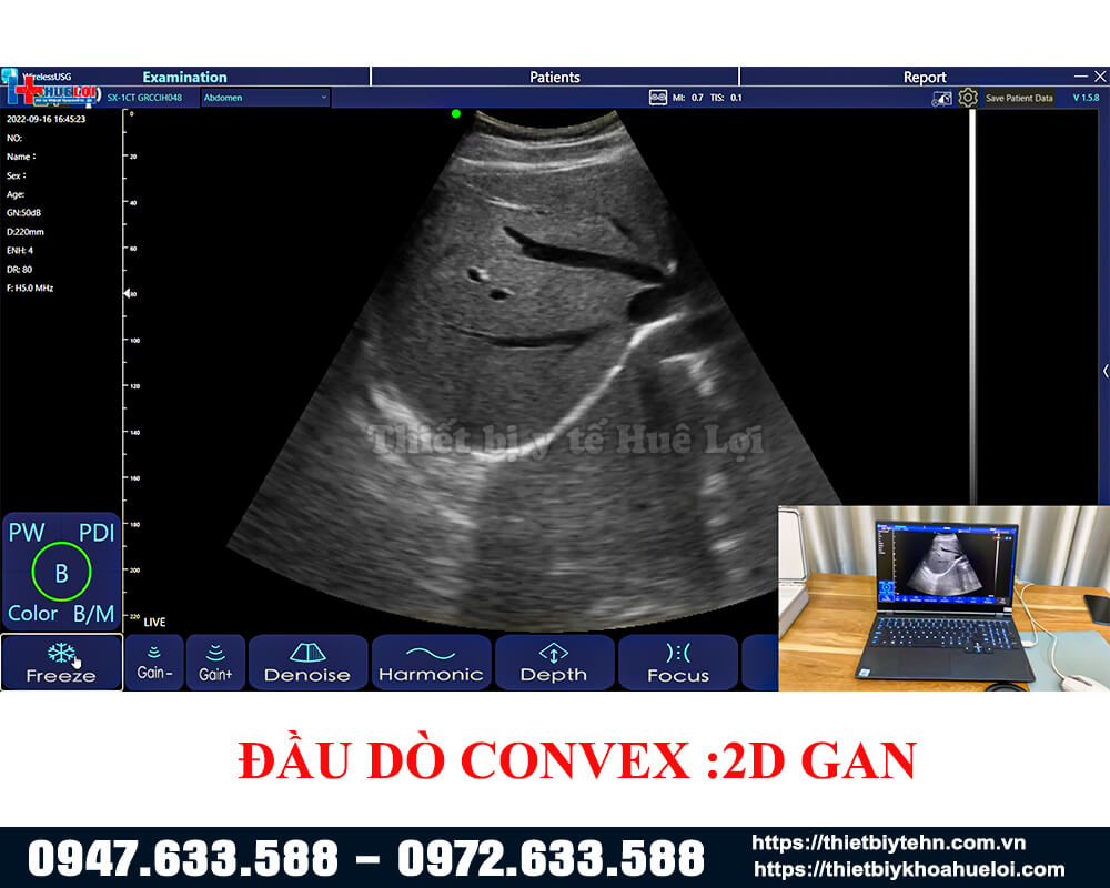 Convex-2d-gan