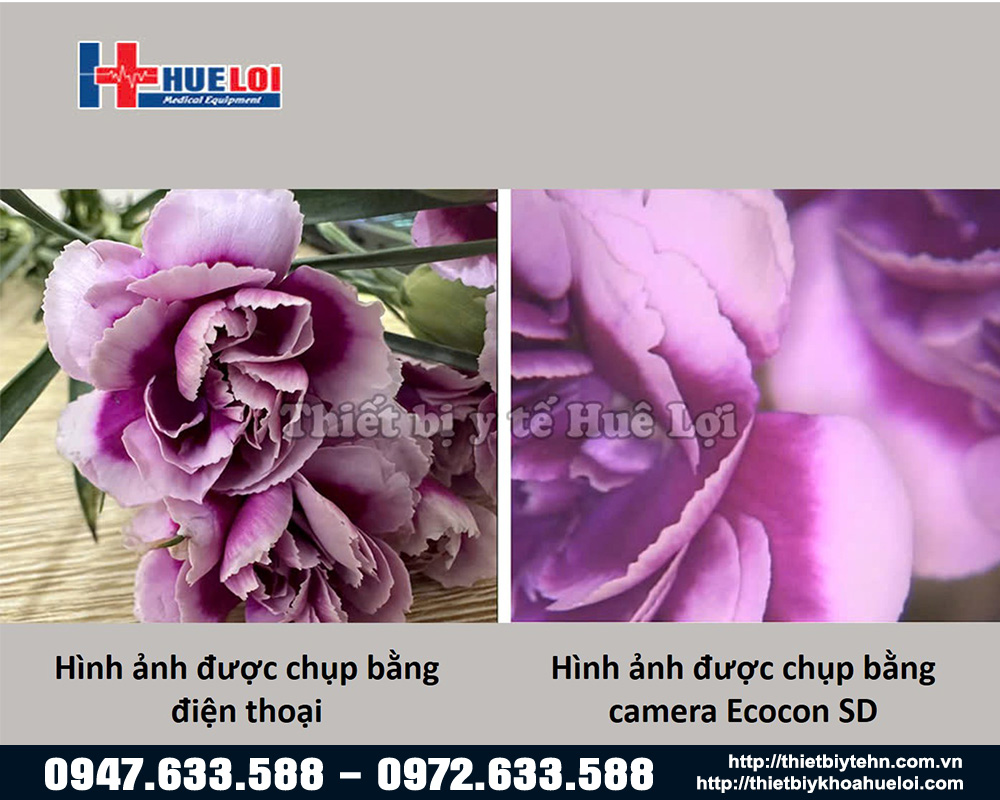 So sánh chất lượng hình ảnh máy Ecocon SD